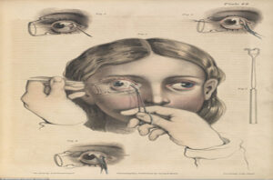 pt1-300x198