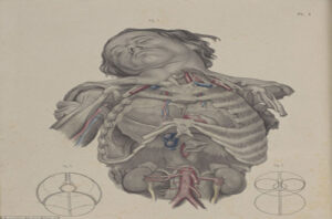 pt11-300x198